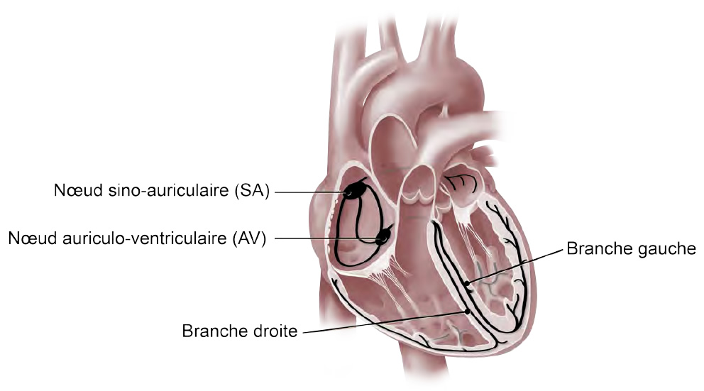 Coupe transversale du cœur montrant les principales parties du système électrique : le nœud sino-auriculaire, le nœud auriculo-ventriculaire, et les branches du faisceau gauches et droites. 