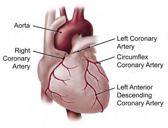 Medical illustration of a heart showing the aorta, right coronary artery, left main coronary artery, circumflex coronary artery and left anterior descending coronary artery, which work together to pump blood around the body.