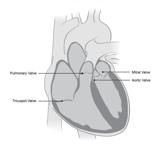 Medical illustration of a heart showing the valves which do not close tightly enough in mitral regurgitation.