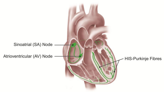 Medical illustration of a heart showing the sinoatrial node, the atrioventricular node, and the His-Purkinjie fibres, which control the electrical impulse that causes your heart to pump.