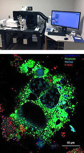 The Zeiss Elyra S.1 LSM 880 with Airyscan confocal laser scanning microscope