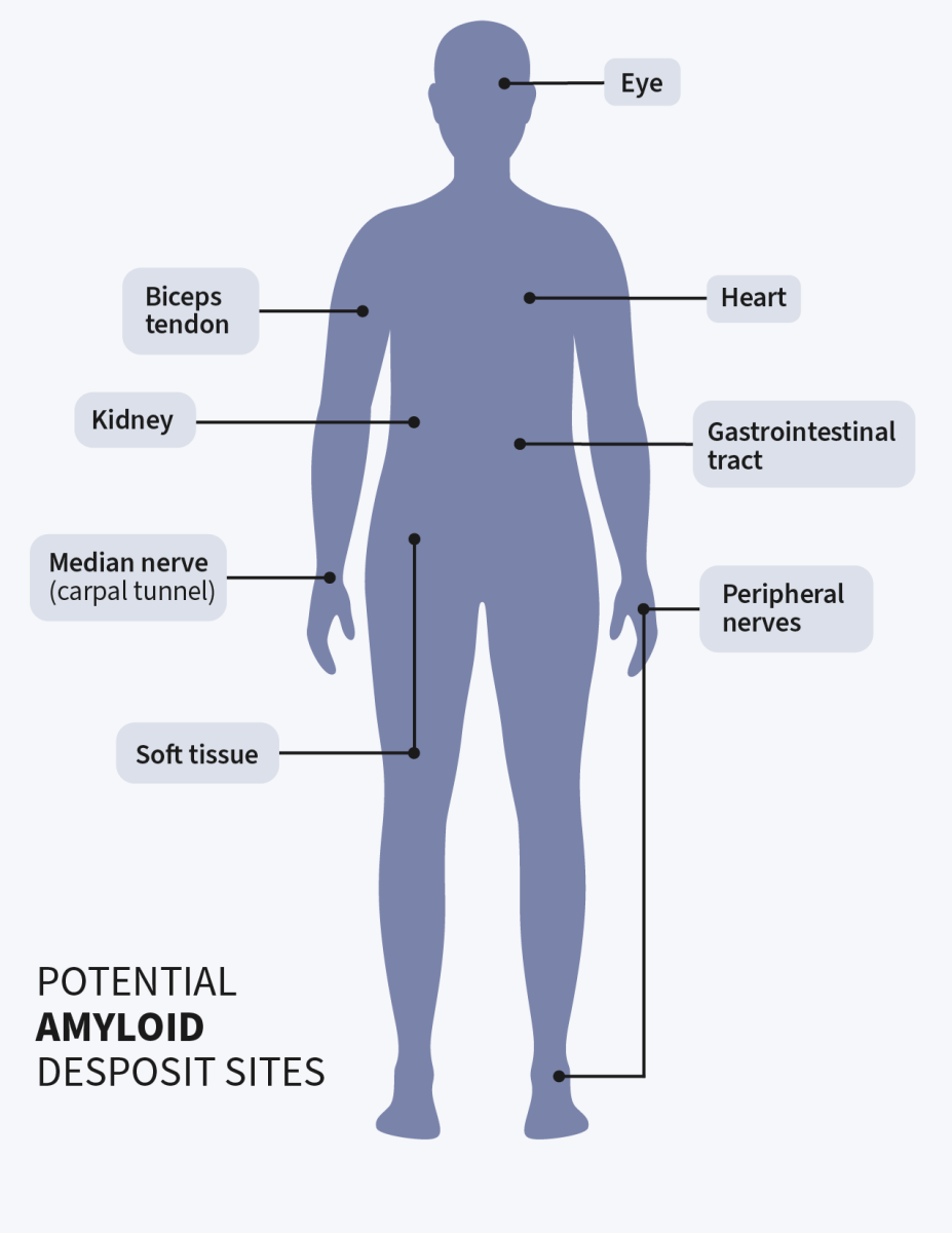 Potential amyloid deposit sites: eye, heart, gastrointestinal tract, peripheral nerves, soft tissue, median nerve (carpal tunnel), kidney and biceps tendon.