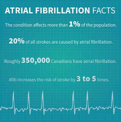 Atrial Fibrillation Facts: The condition affects more than 1% of the population. 20% of all strokes are caused by atrial fibrillation. Roughly 350,000 Canadians have atrial fibrillation. Afib increases the risk of stroke by 3 to 5 times.
