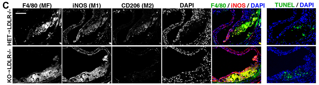 Sous l’effet d’une alimentation riche en gras, les souris dont le gène IRF2BP2 a été inactivé produisent plus de macrophages enflammés qui s’accumulent dans la plaque de leurs artères que les souris chez qui ce gène est actif, ce qui entraîne une aggravation de la coronaropathie.