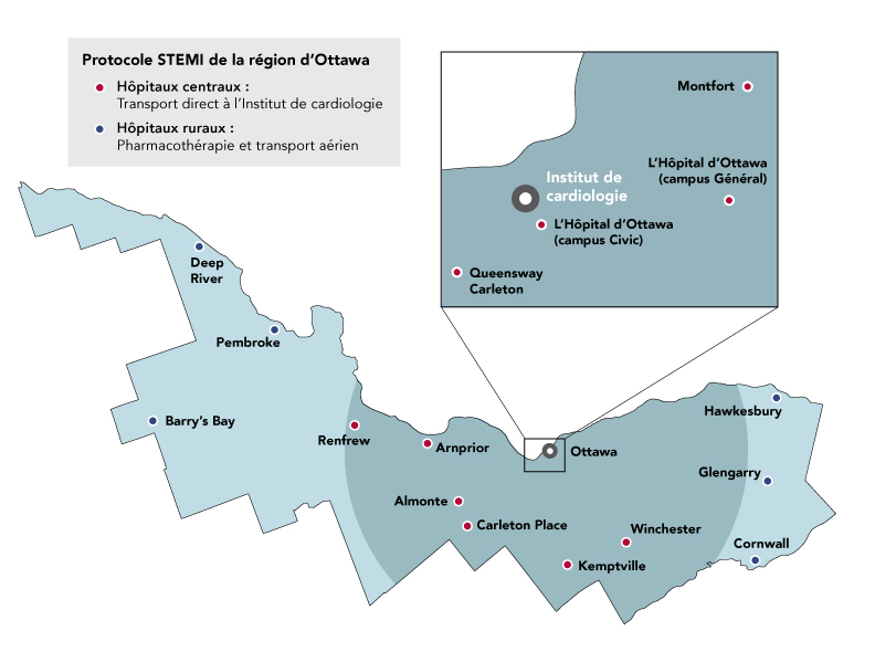 Protocole STEMI de la région d'Ottawa