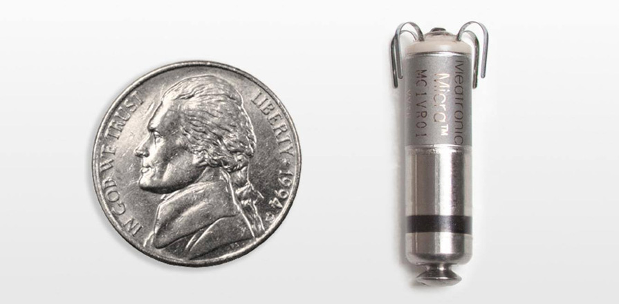 An American nickel next to a new leadless transcatheter pacing system