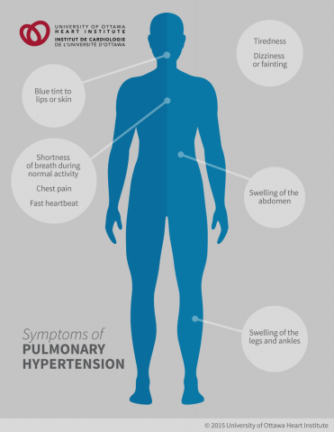 Pulmonary Hypertension - Ottawa Heart Institute