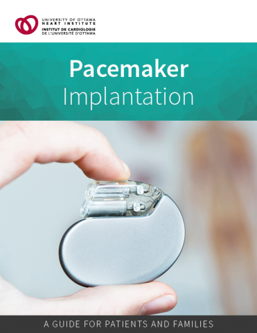 Pacemaker Implantation Patient Guide