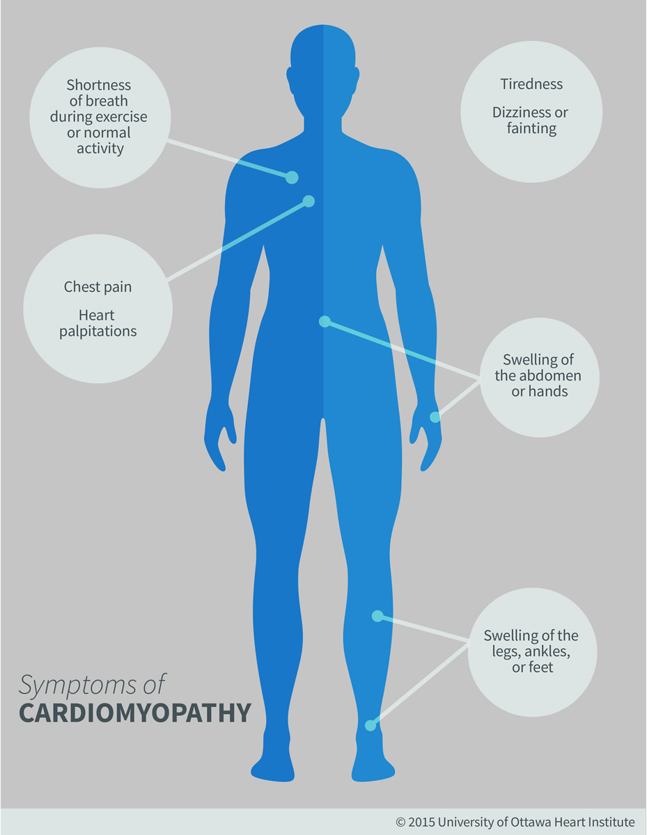 Cardiomyopathy Ottawa Heart Institute