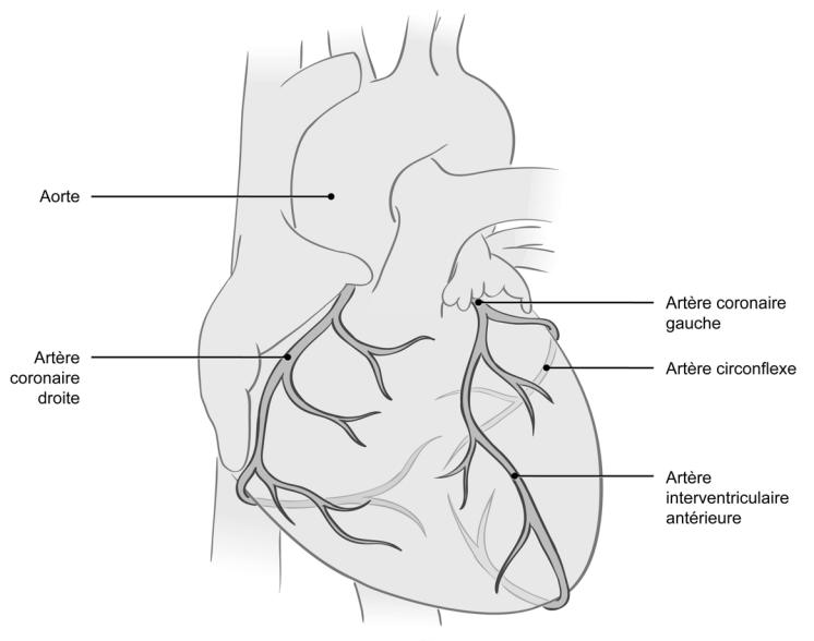 Angiographie (Cathétérisme cardiaque) – Institut de cardiologie de  l'Université d'Ottawa