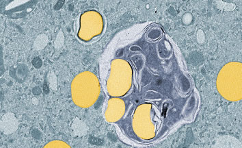 Un autophagosome (en bleu) emprisonne des gouttelettes de gras (en jaune)