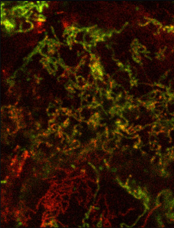 Oxidative stress in mitochondria (shown in red)